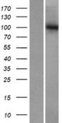 Western Blot: gtf3c3 Overexpression Lysate [NBP2-07494]