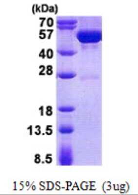 SDS-PAGE: Recombinant Human Guanine deaminase His Protein [NBP2-23093]