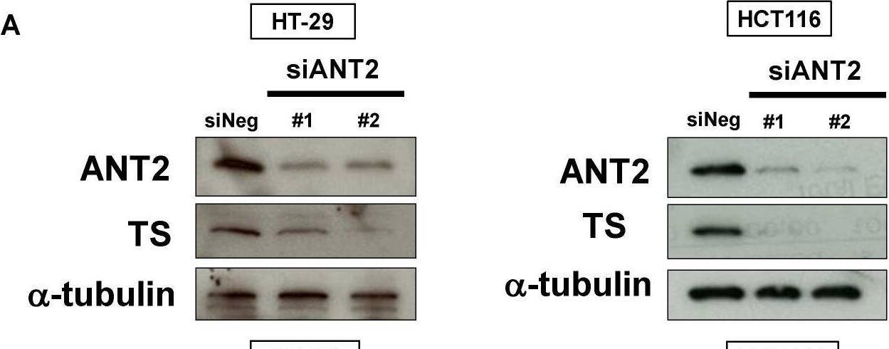 Adenine Nucleotide Translocator 2 Antibody - Azide and BSA Free