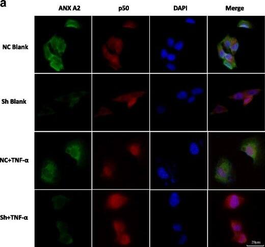 Annexin A2 Antibody (1G7)