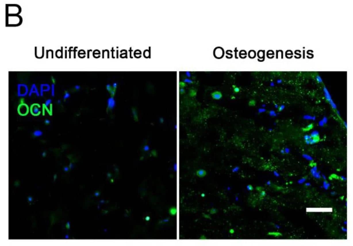 Osteocalcin Antibody (2D4)