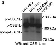 CSE1L/CAS/Exportin-2 Antibody (3D8)