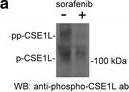 CSE1L/CAS/Exportin-2 Antibody (3D8)