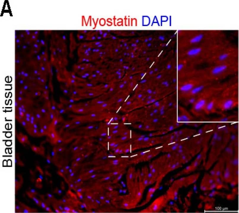 GDF-8/Myostatin Antibody (3E7)