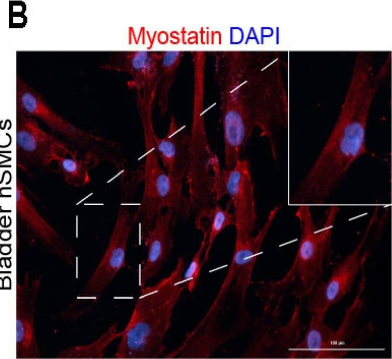 GDF-8/Myostatin Antibody (3E7)