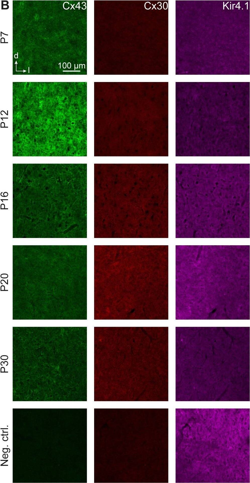 KCNJ10 Antibody (1C11)