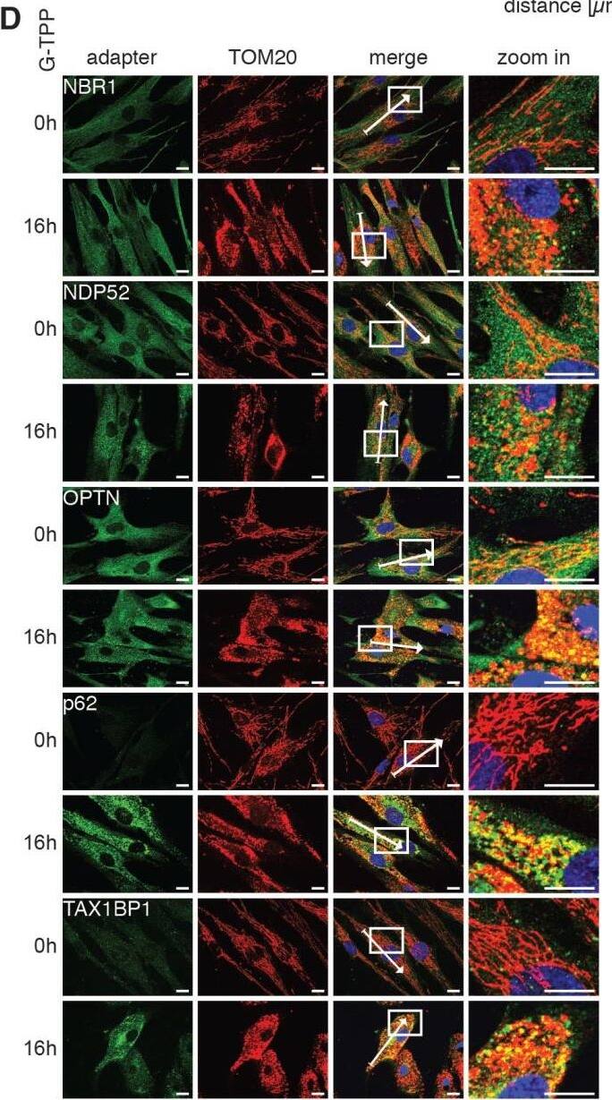NBR1 Antibody (6B11)