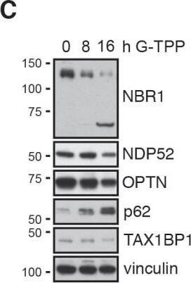 NBR1 Antibody (6B11)