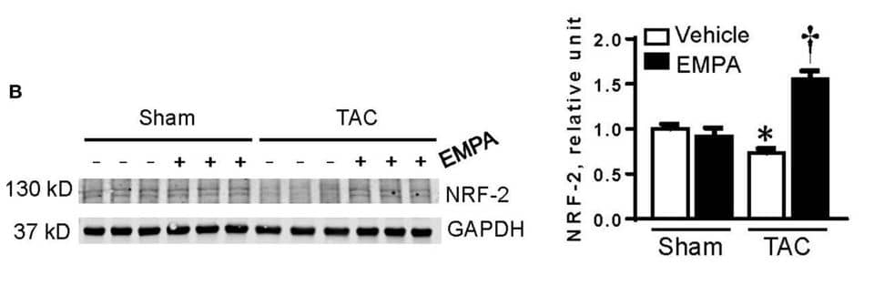 Nrf2 Antibody (2G7)