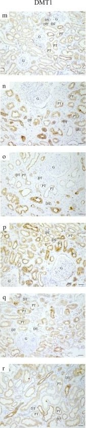NRAMP2/SLC11A2/DMT1 Antibody (4C6)