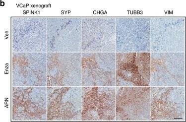 SPINK1 Antibody (4D4)
