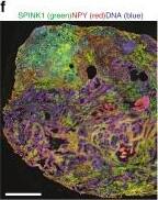 SPINK1 Antibody (4D4)