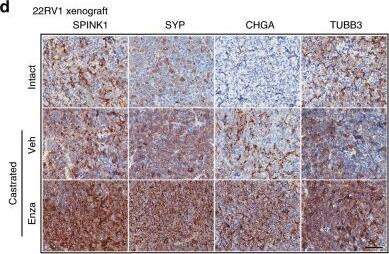 SPINK1 Antibody (4D4)