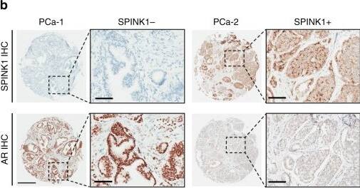 SPINK1 Antibody (4D4)