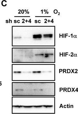 Peroxiredoxin 2 Antibody (4E10-2D2)