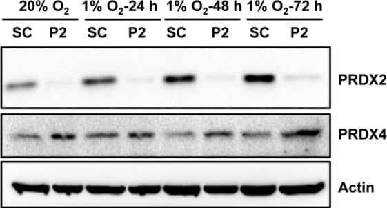 Peroxiredoxin 2 Antibody (4E10-2D2)