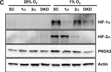Peroxiredoxin 2 Antibody (4E10-2D2)