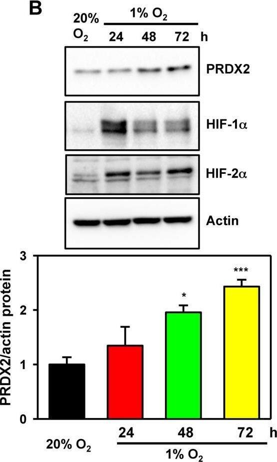 Peroxiredoxin 2 Antibody (4E10-2D2)