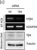 Thymosin beta 4 Antibody