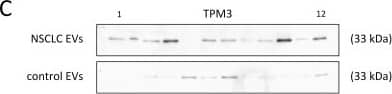 tropomyosin-3 Antibody (2E4)