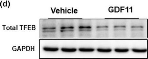 TFEB Antibody (S1)