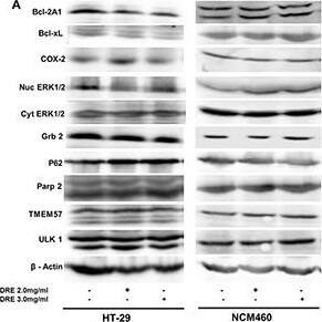 p62/SQSTM1 Antibody (2C11)