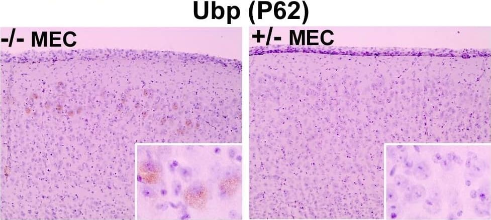 p62/SQSTM1 Antibody (2C11)