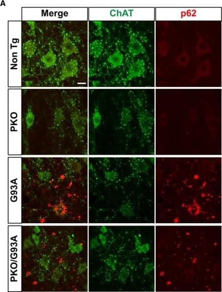 p62/SQSTM1 Antibody (2C11)