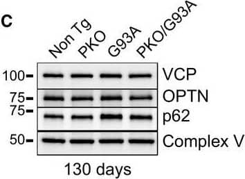 p62/SQSTM1 Antibody (2C11)