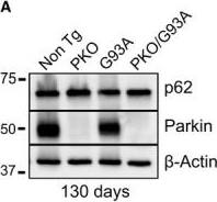p62/SQSTM1 Antibody (2C11)
