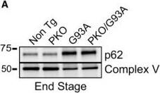 p62/SQSTM1 Antibody (2C11)