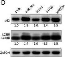 p62/SQSTM1 Antibody (2C11)