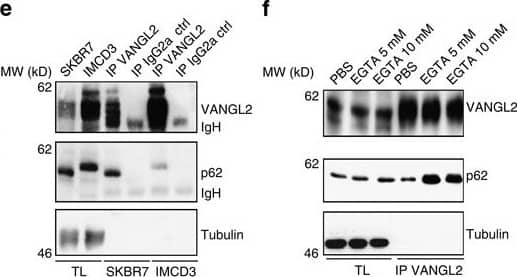 p62/SQSTM1 Antibody (2C11)