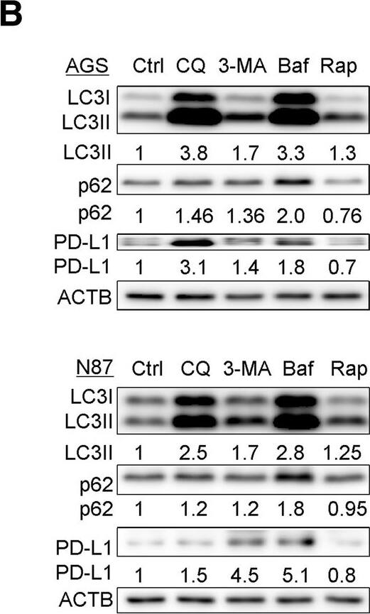 p62/SQSTM1 Antibody (2C11)