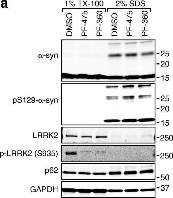 p62/SQSTM1 Antibody (2C11)