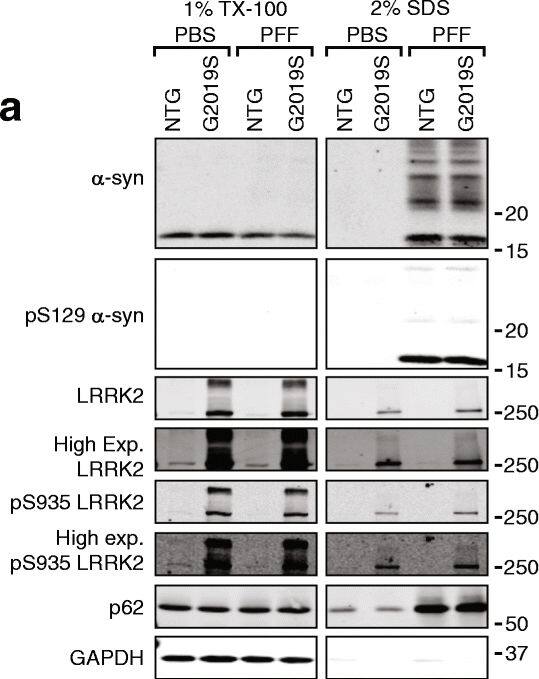 p62/SQSTM1 Antibody (2C11)
