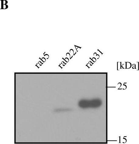 RAB31 Antibody (1C6)