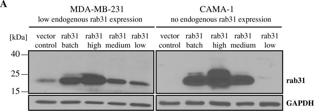RAB31 Antibody (1C6)