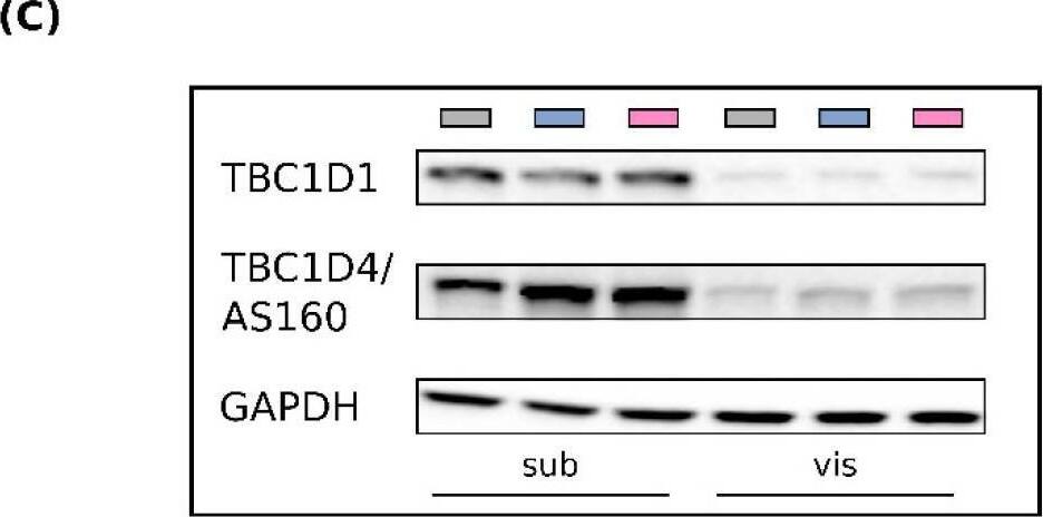 TBC1D1 Antibody - Azide and BSA Free