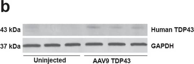 TDP-43/TARDBP Antibody (2E2-D3)