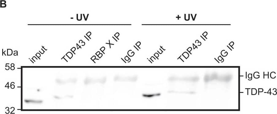 TDP-43/TARDBP Antibody (2E2-D3)