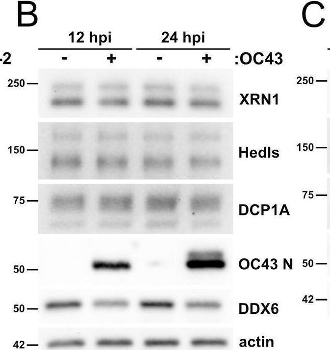 Dcp1a Antibody (3G4) - Azide and BSA Free