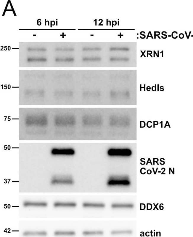 Dcp1a Antibody (3G4) - Azide and BSA Free