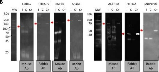 ACTR10 Antibody