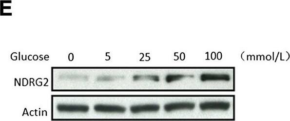 NDRG2 Antibody (6A5)