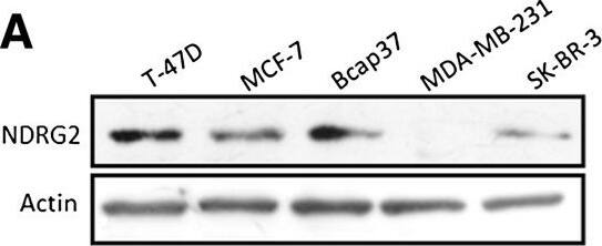 NDRG2 Antibody (6A5)