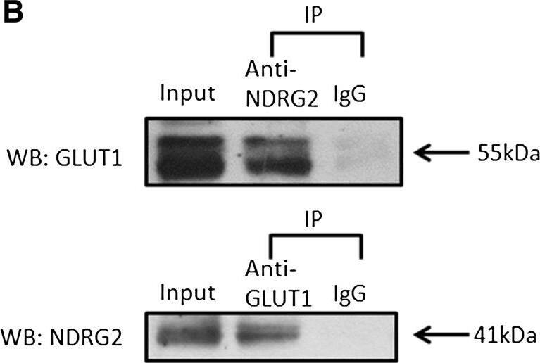 NDRG2 Antibody (6A5)