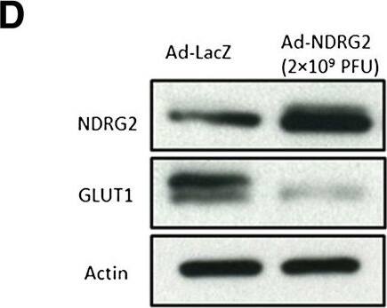 NDRG2 Antibody (6A5)