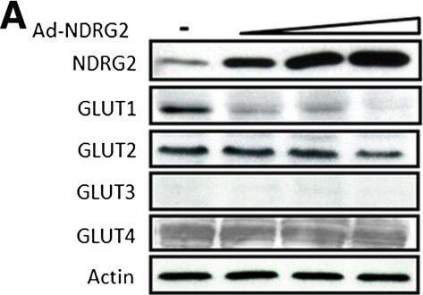 NDRG2 Antibody (6A5)