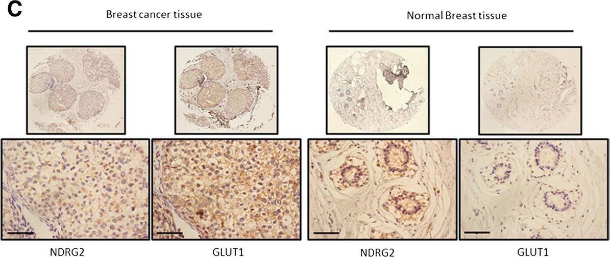NDRG2 Antibody (6A5)
